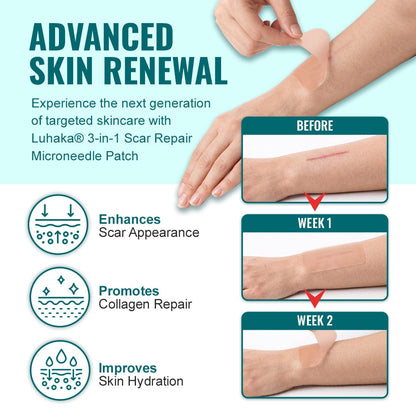 Luhaka® Advanced 3-in-1 Scar Repair Microneedle Patch 🏆1