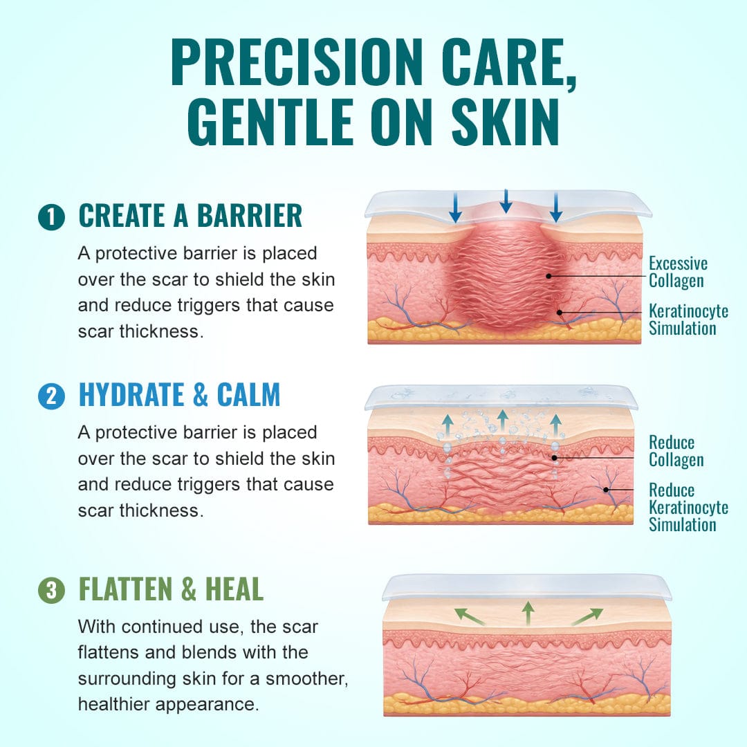 Luhaka® Advanced 3-in-1 Scar Repair Microneedle Patch 🏆1