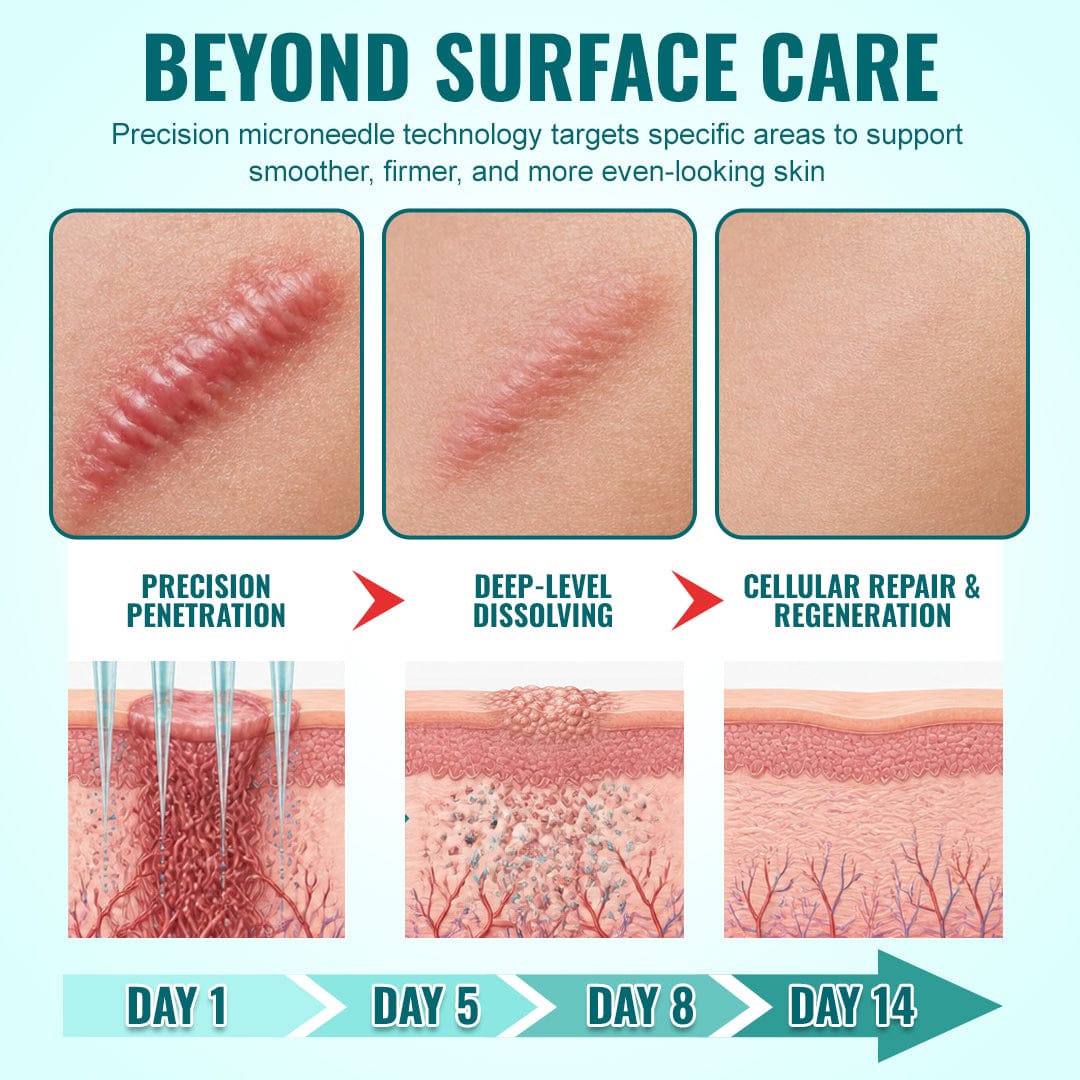 Luhaka® Advanced 3-in-1 Scar Repair Microneedle Patch 🏆1