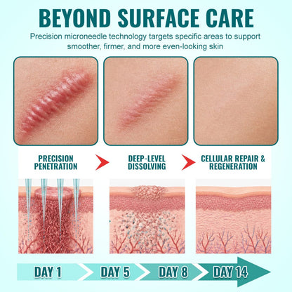Luhaka® Advanced 3-in-1 Scar Repair Microneedle Patch 🏆1