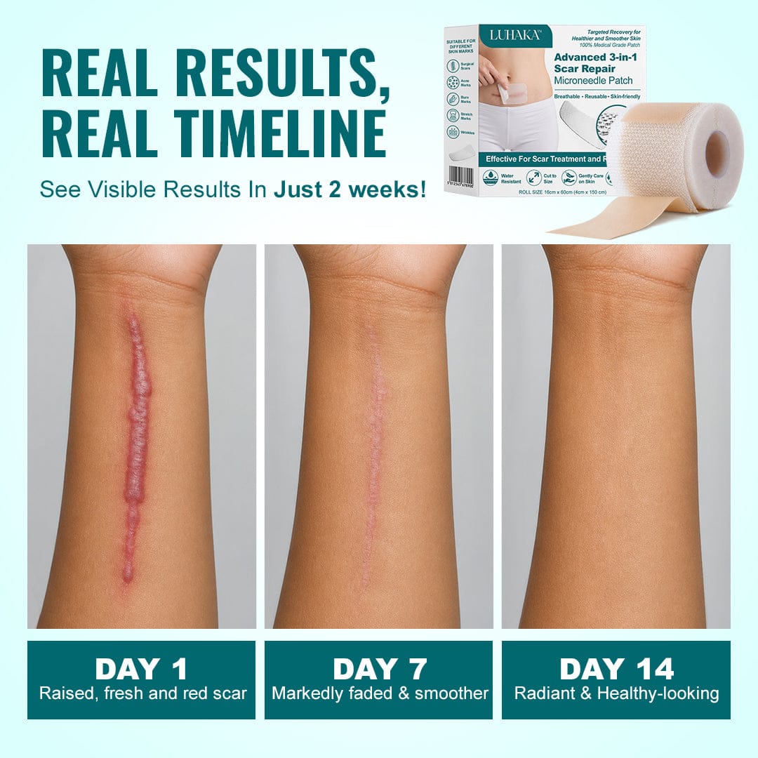 Luhaka® Advanced 3-in-1 Scar Repair Microneedle Patch 🏆1