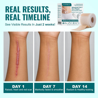 Luhaka® Advanced 3-in-1 Scar Repair Microneedle Patch 🏆1