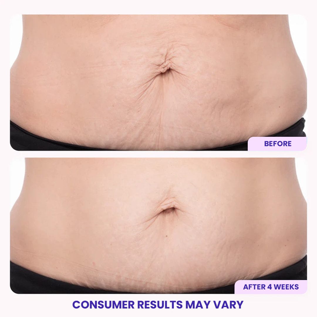 DOPURE Firming Belly Cream ACE