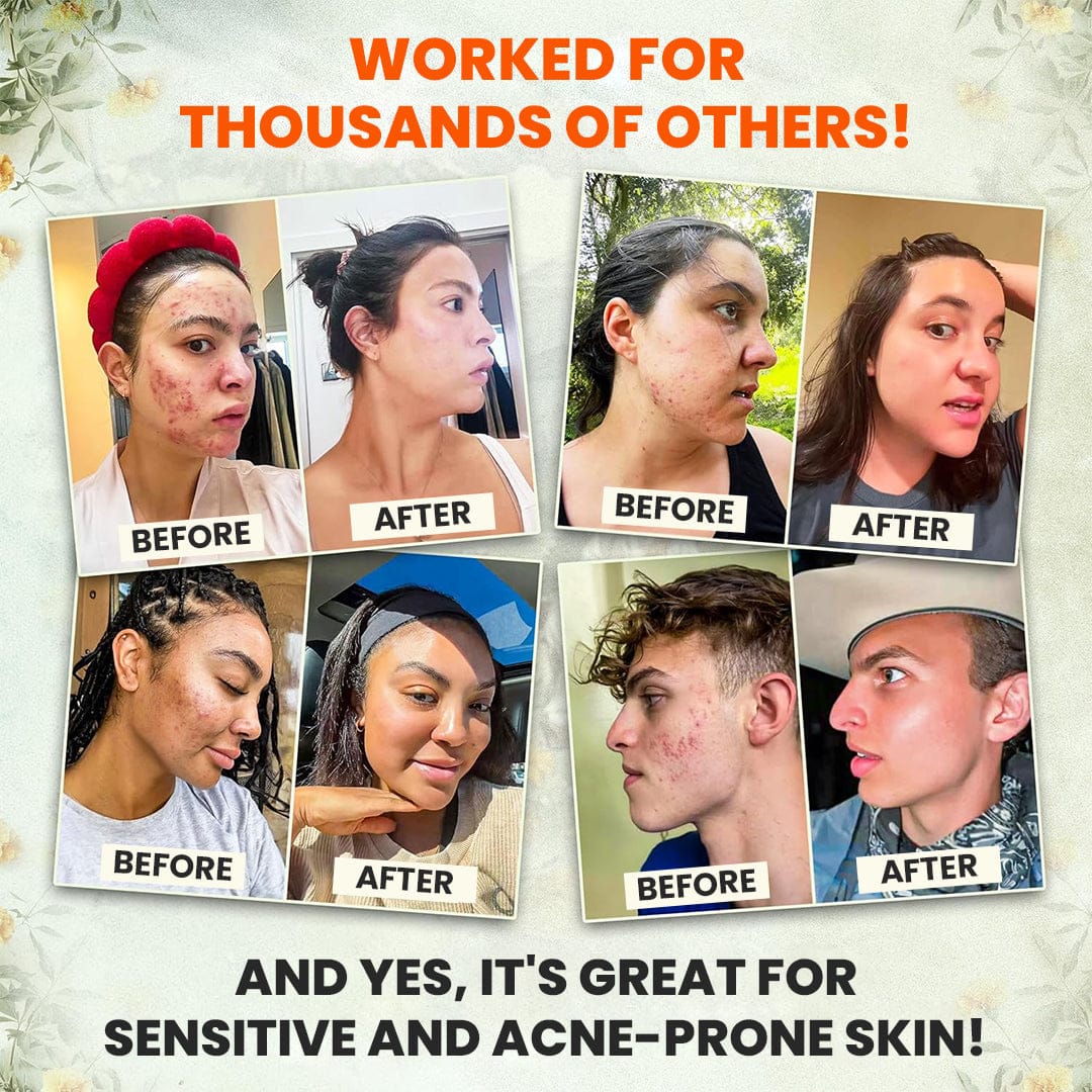 Whipped Beef Tallow and Honey Balm_Ultra02