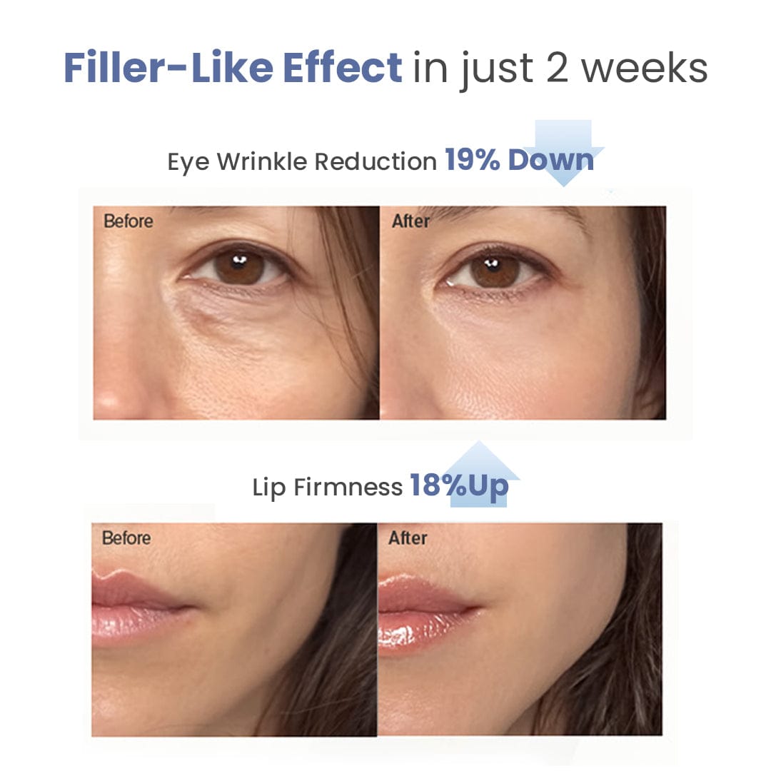 Intensive Collagen Care Set [Silk Collagen & Peptide Face-Lift Duo]