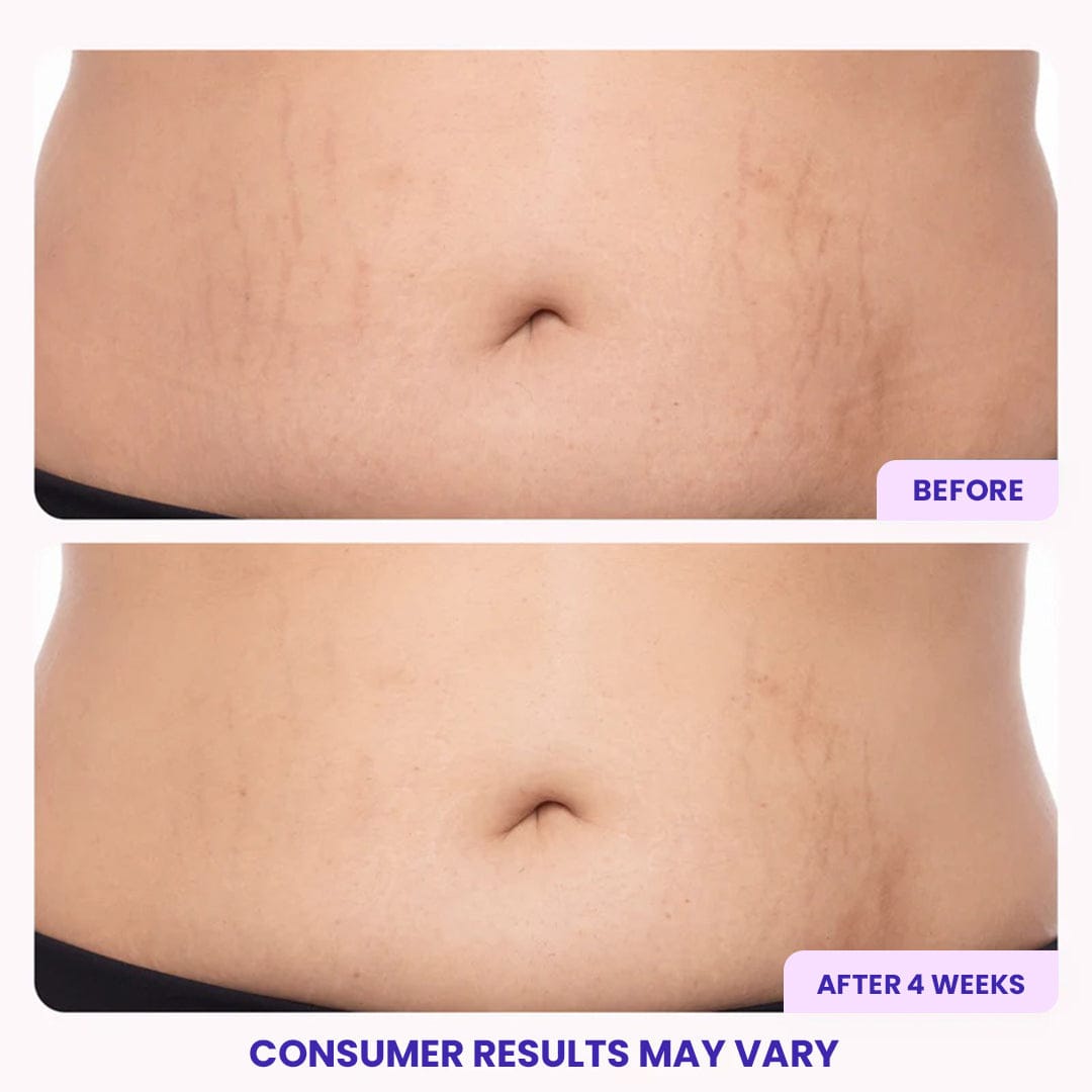 DOPURE Firming Belly Cream ACE