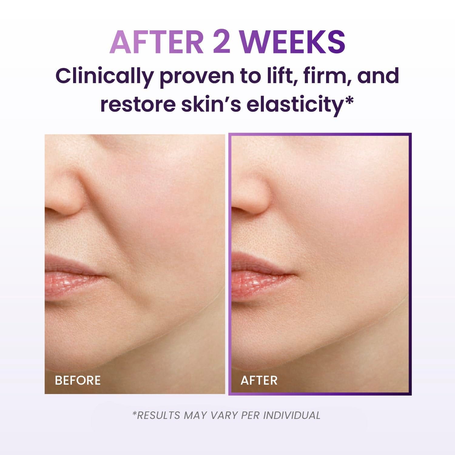 3D Lifting Cream_Ultra01