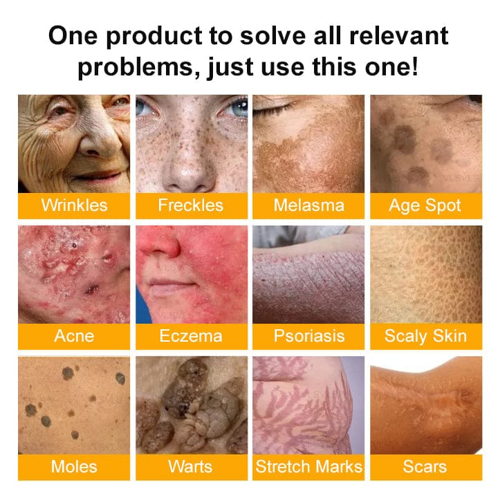 The "Forbidden" Natural Discovery That Erases Years of Skin Damage & Ends The Daily Battle With Psoriasis, Wrinkles & Chronic Skin Conditions