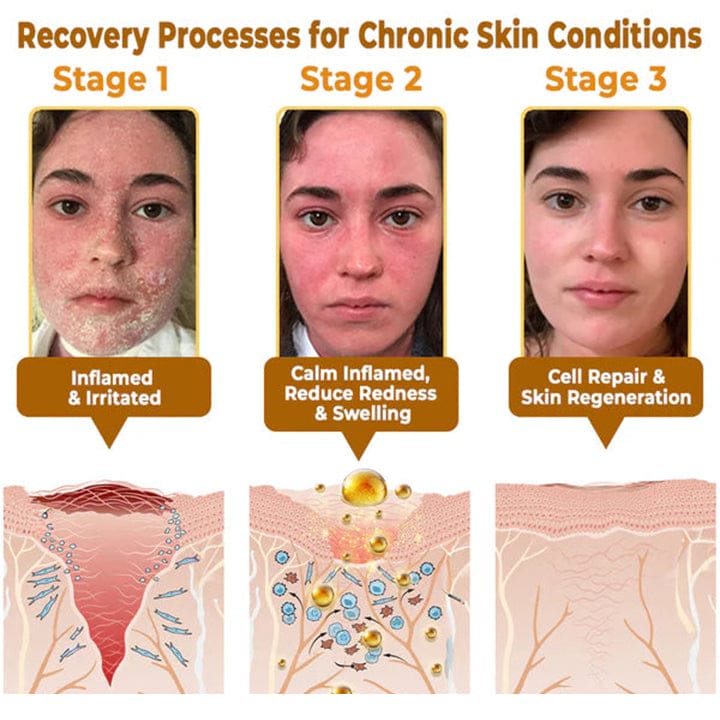 The "Forbidden" Natural Discovery That Erases Years of Skin Damage & Ends The Daily Battle With Psoriasis, Wrinkles & Chronic Skin Conditions