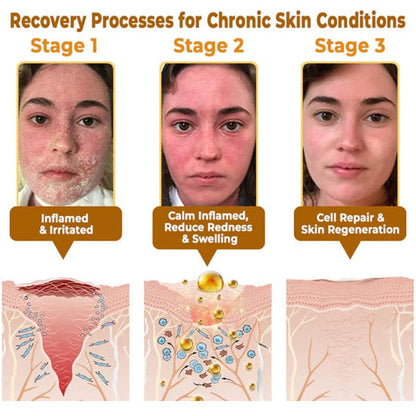 The "Forbidden" Natural Discovery That Erases Years of Skin Damage & Ends The Daily Battle With Psoriasis, Wrinkles & Chronic Skin Conditions