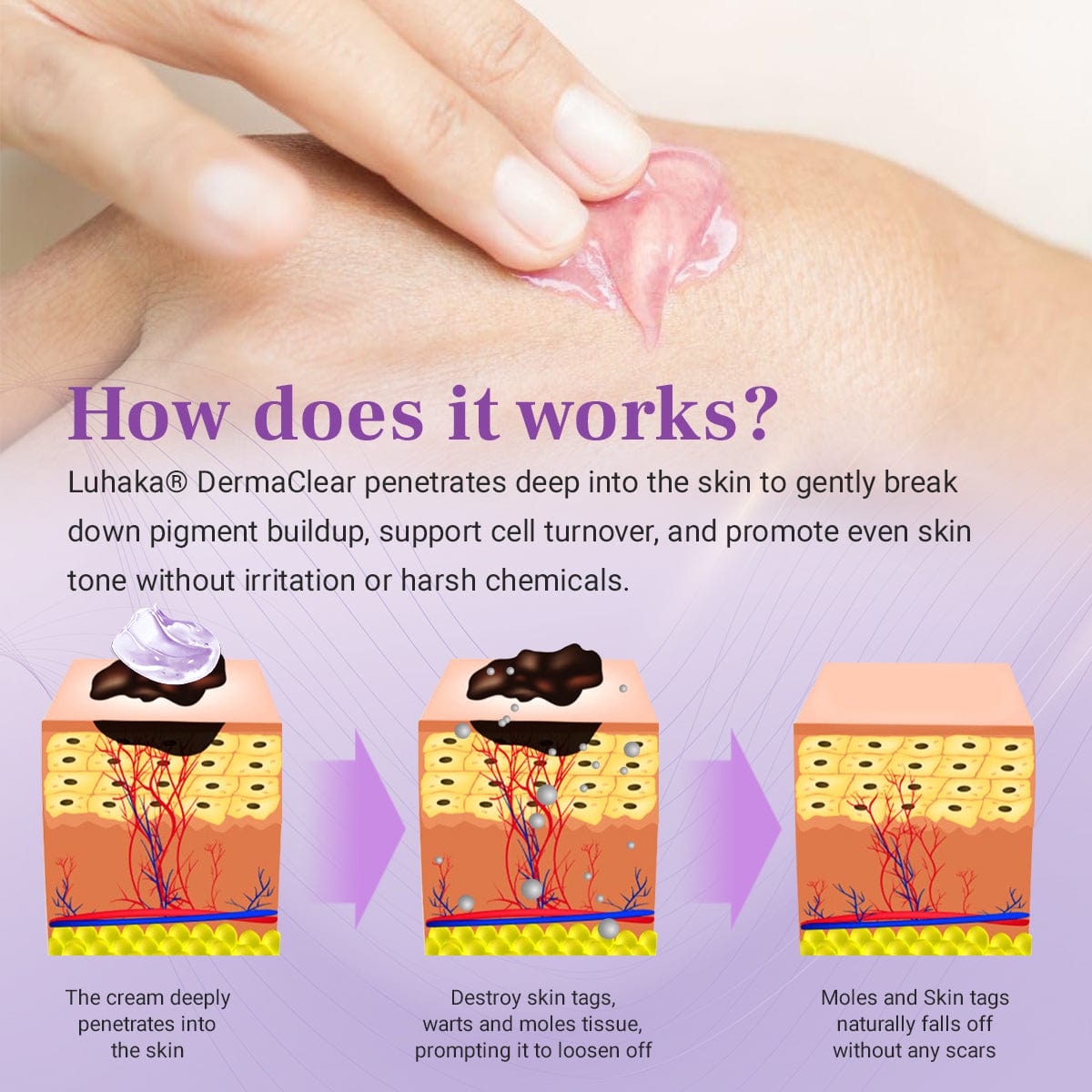 Luhaka® DermaClear Mole and Dark Spot Removal Bio-Gel💞3