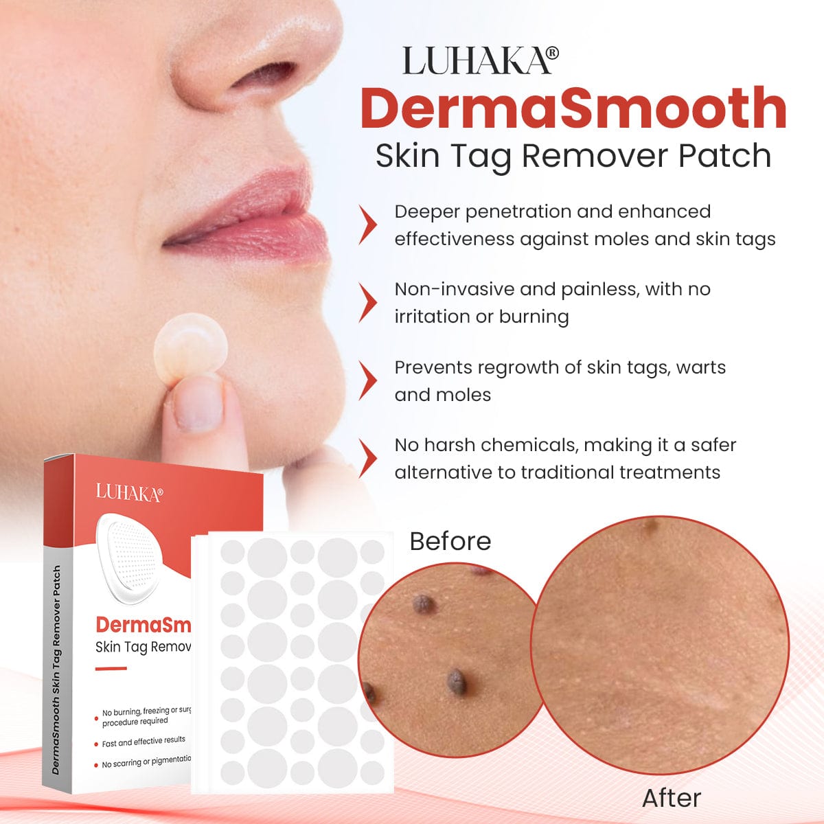Luhaka® DermaSmooth Skin Tag Remover Patch