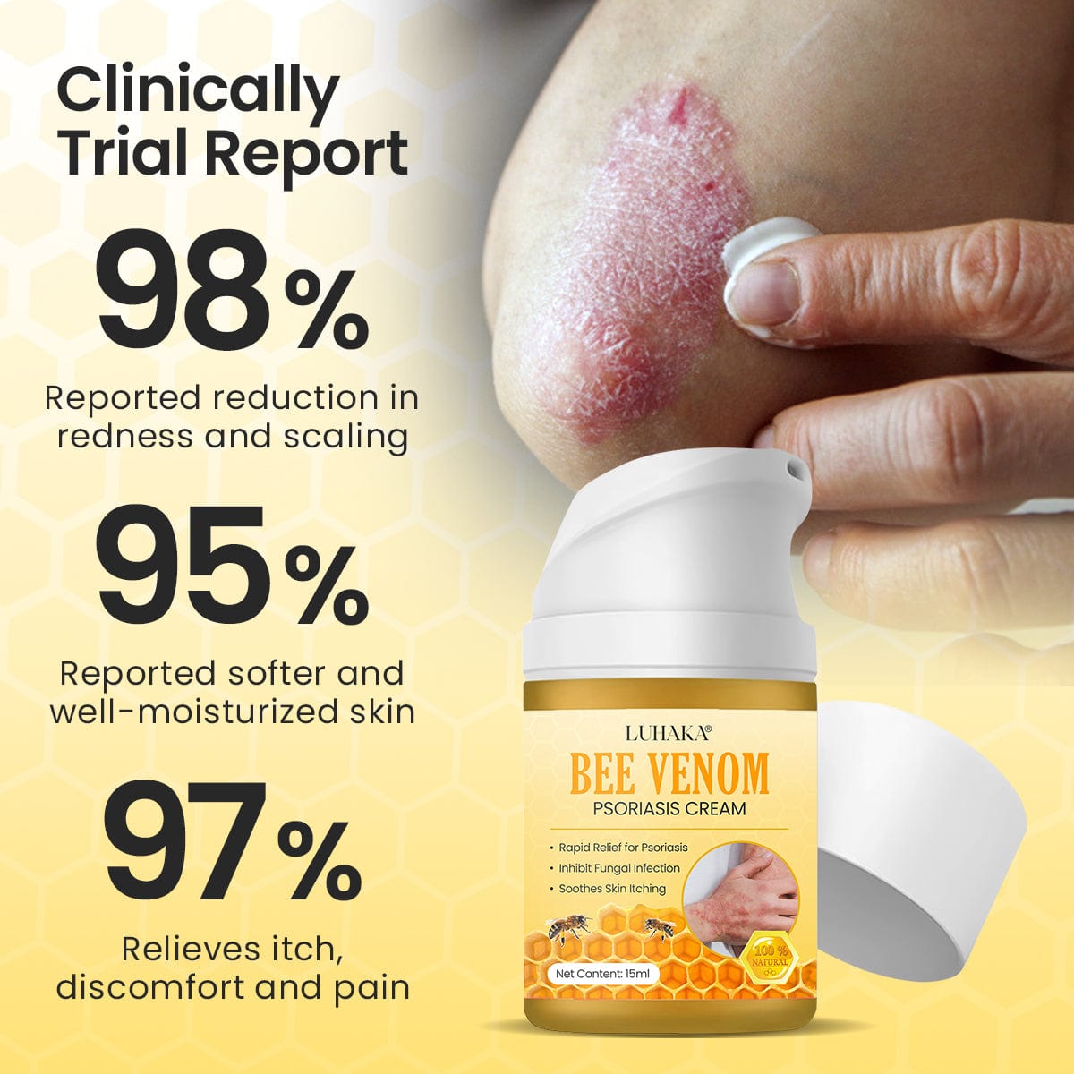 Luhaka® Bee Venom Psoriasis Cream