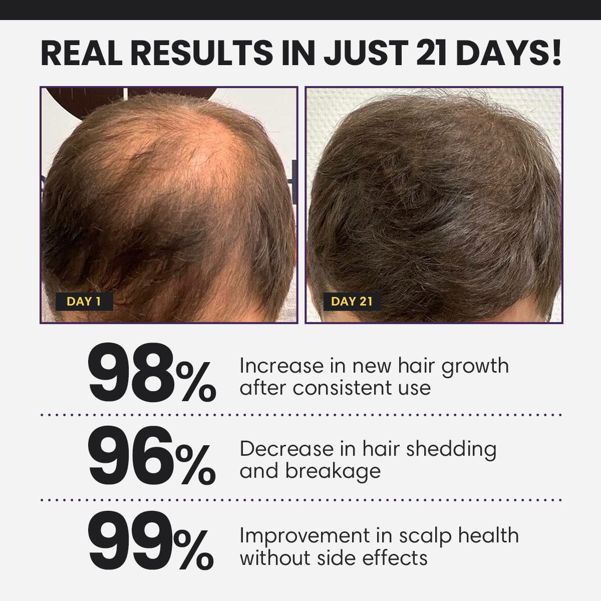 Dafeila® FollicleBoost 5X Hair Growth Serum💞3