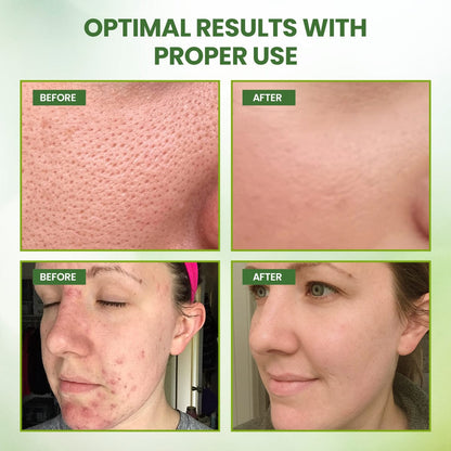 KISSHI™ Green Tea Mask Stick