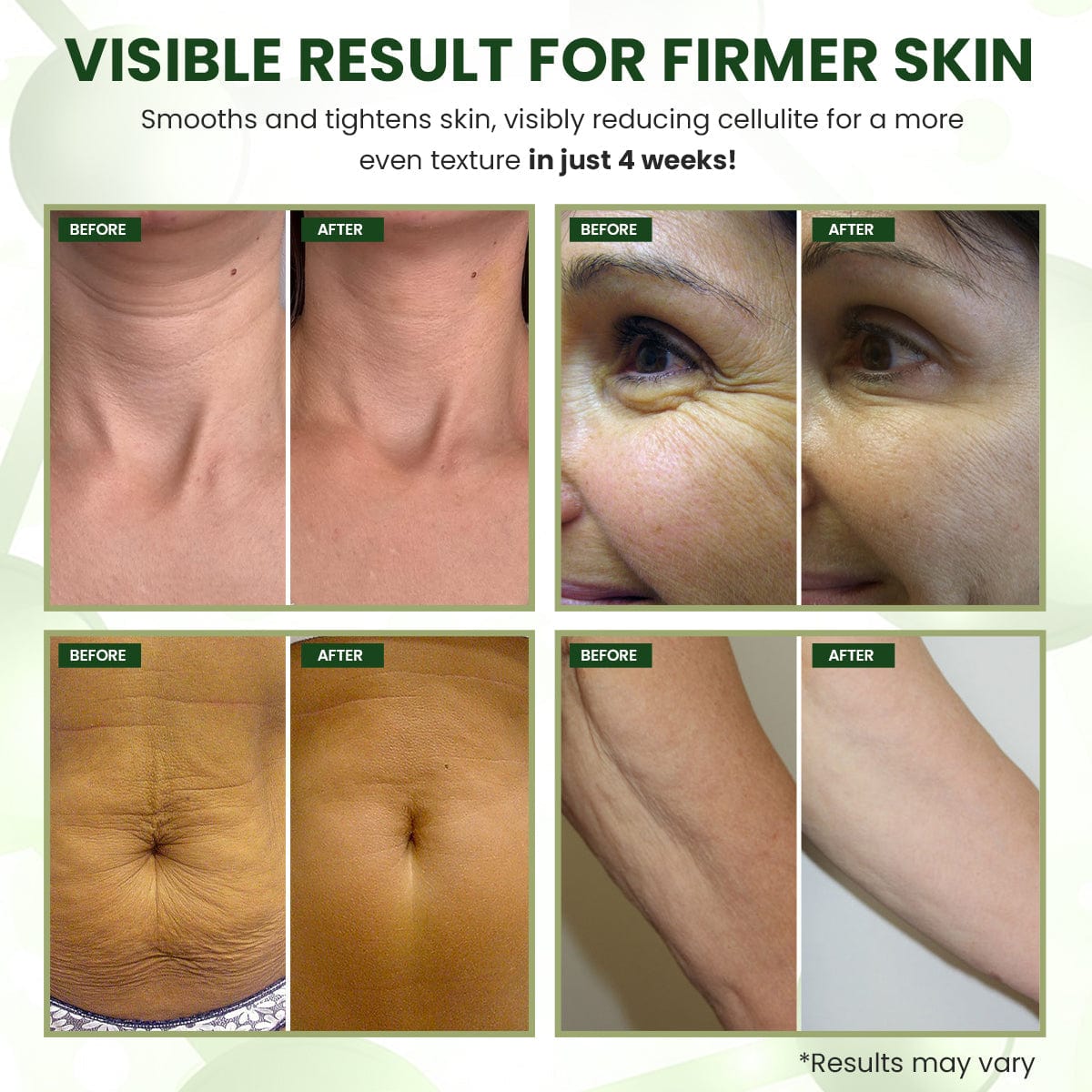 Luhaka® RevitaDerm Luxurious Collagen Firming Cream ✨