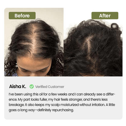 Labenta Batana Oil For Hair Growth