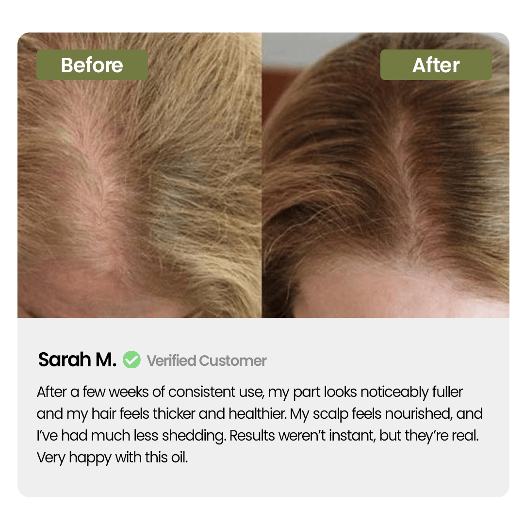 Labenta Batana Oil For Hair Growth