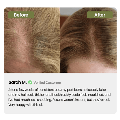 Labenta Batana Oil For Hair Growth