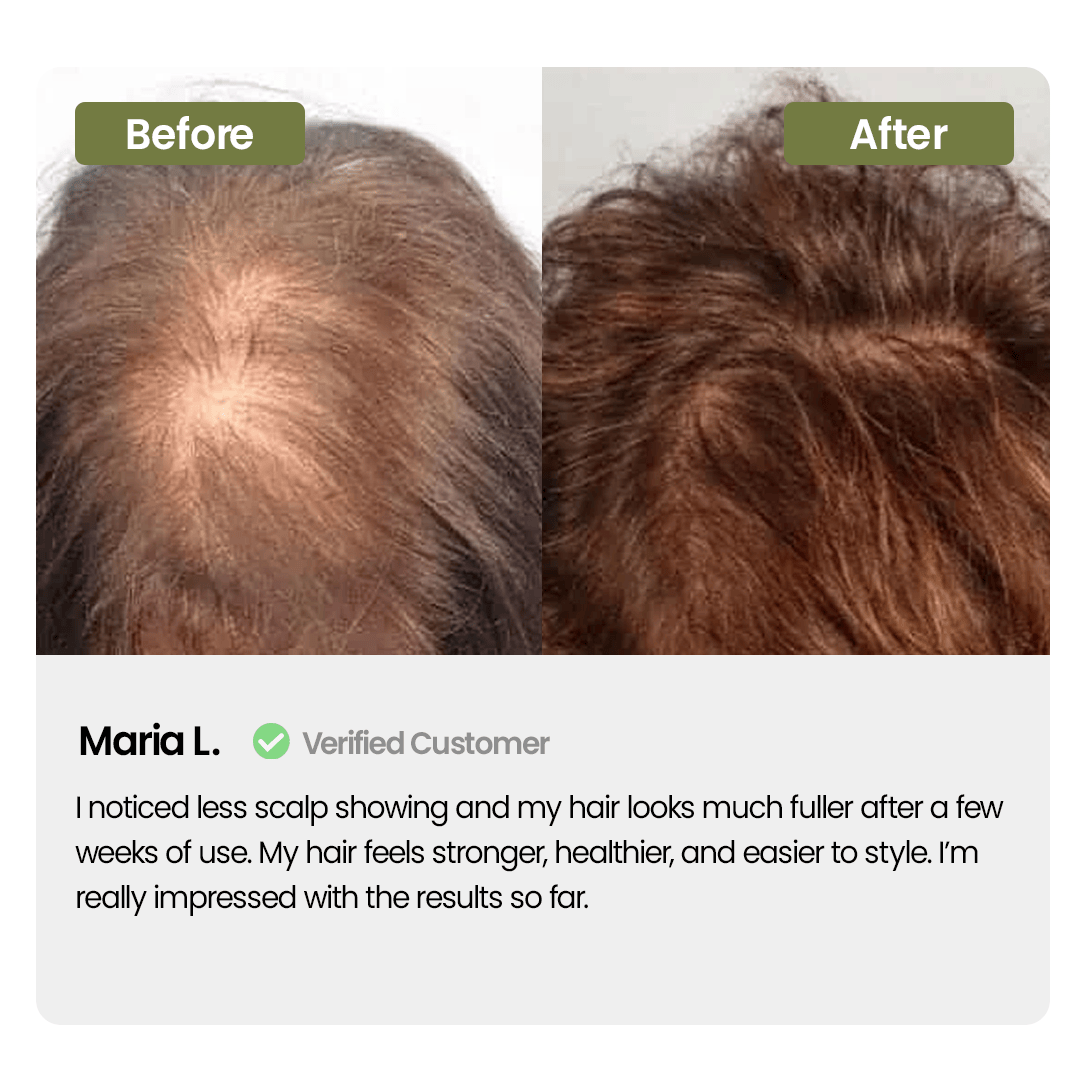 Labenta Batana Oil For Hair Growth