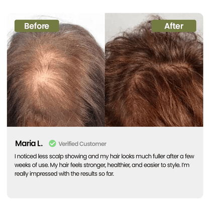 Labenta Batana Oil For Hair Growth