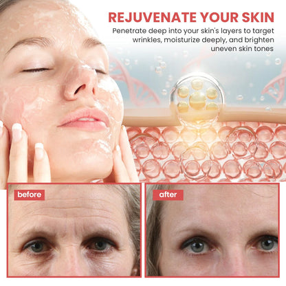 KISSHI™ Advanced Matrixyl 3000 Serum💥Enjoy Special Discounts💥