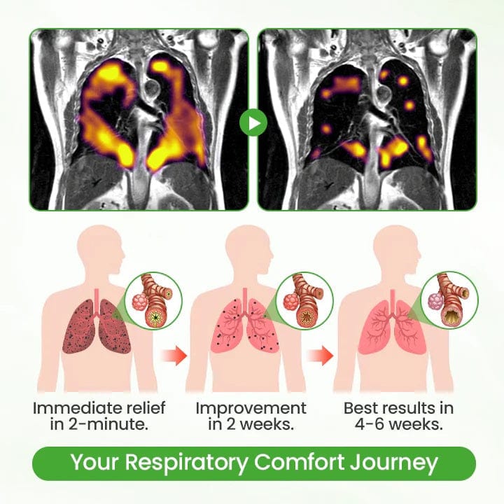 Lyyeto® HerbaAir Mullein Lung Purifier ACE