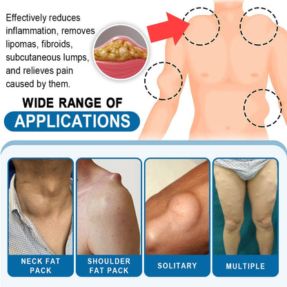 KISSHI™ Lipoma Removal Cream